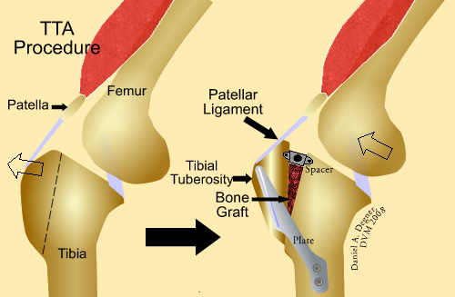 TTA Surgery