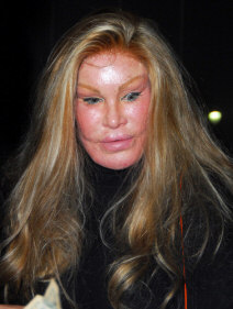 Jocelyn Wildenstein extreme plastic surgery